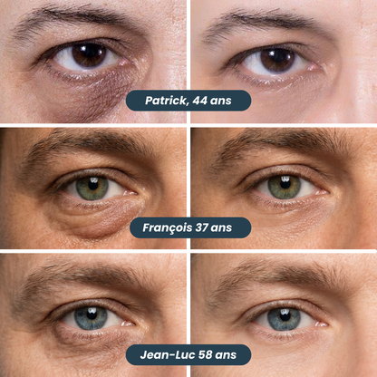 Patchs Anti-Cernes Nouvelle Génération